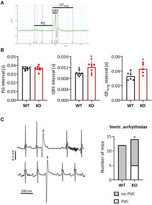 Loss of protein phosphatase 2A regulatory subunit PPP2R5A is associated with increased incidence of stress-induced proarrhythmia